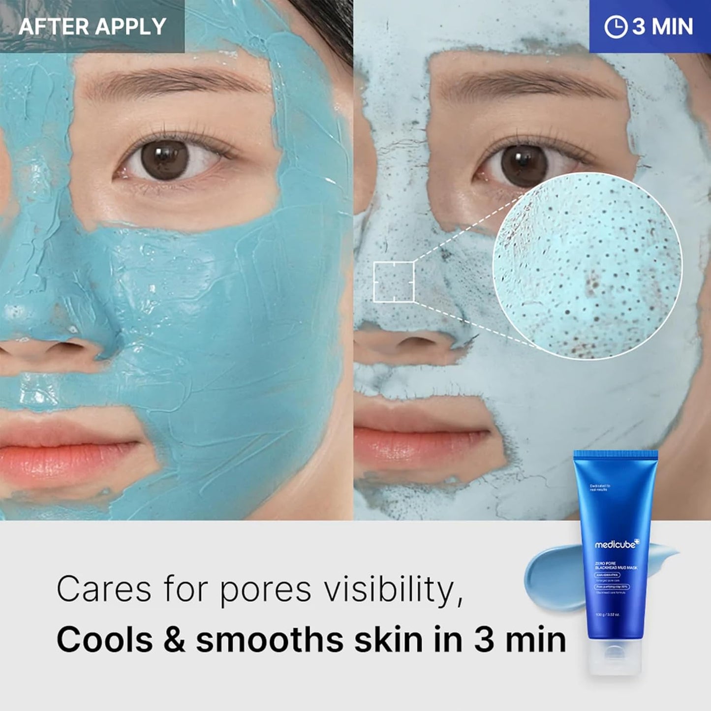 Zero Pore Blackhead Mud Mask by Medicube