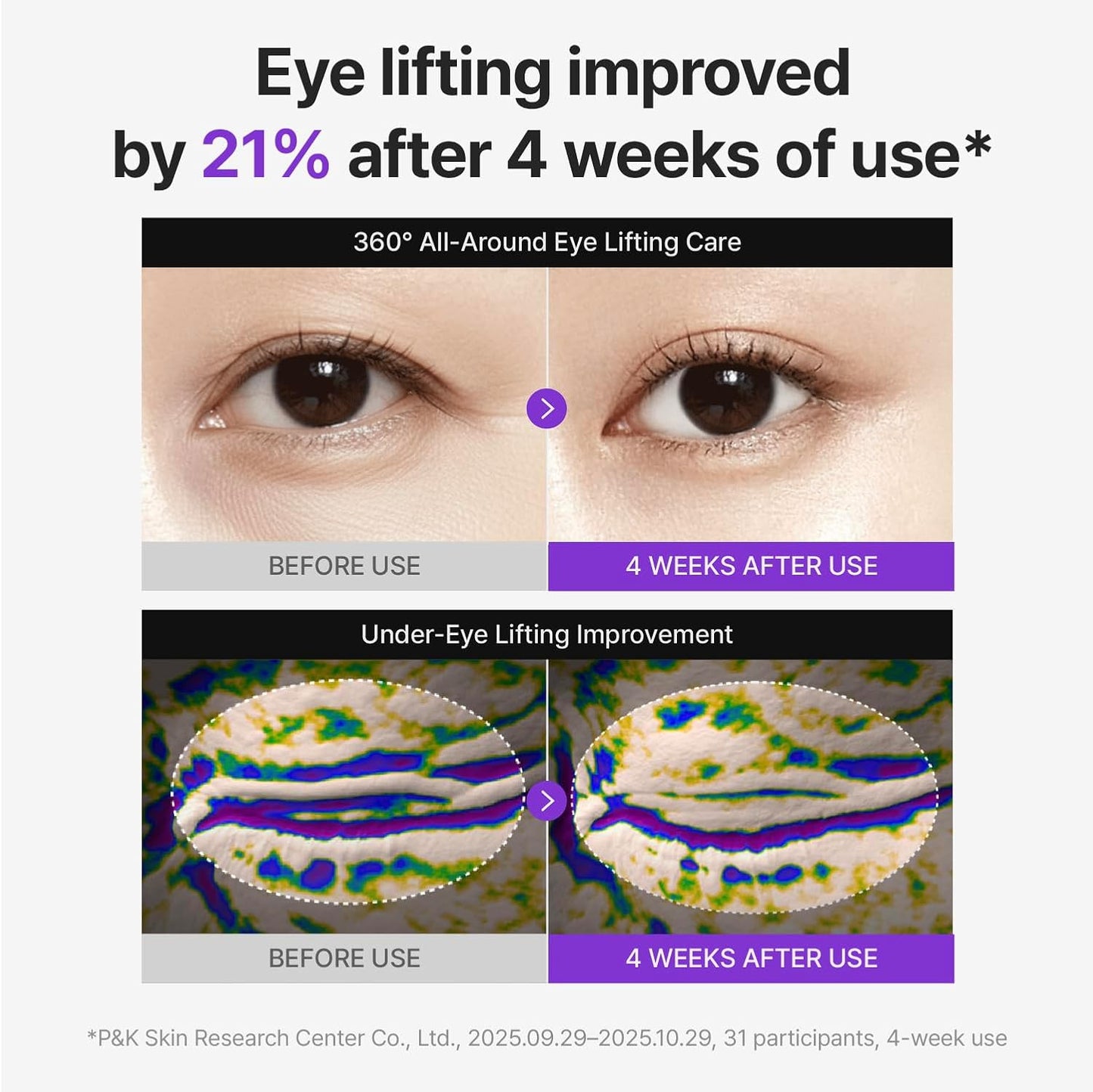 360 Shot PDRN Lifting Eye Cream by Centellian24
