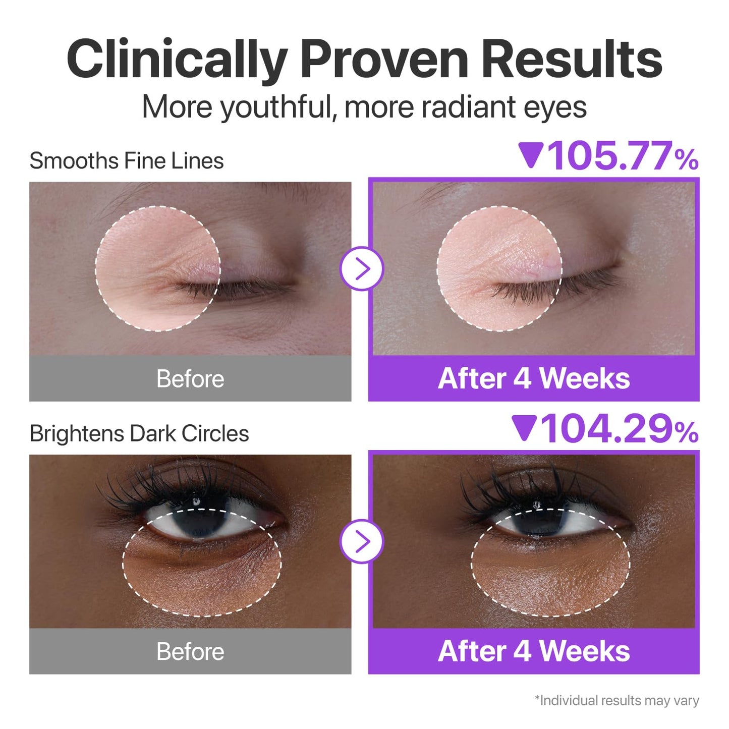 No.9 NAD Retinol Volumetox Eye Cream by Numbuzin