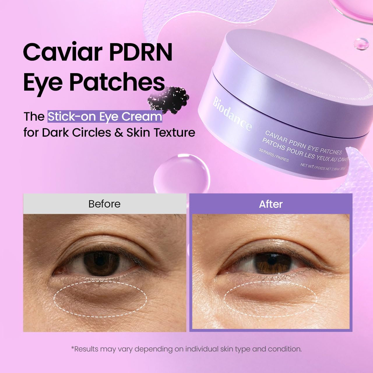 Caviar PDRN Eye Patches by Biodance