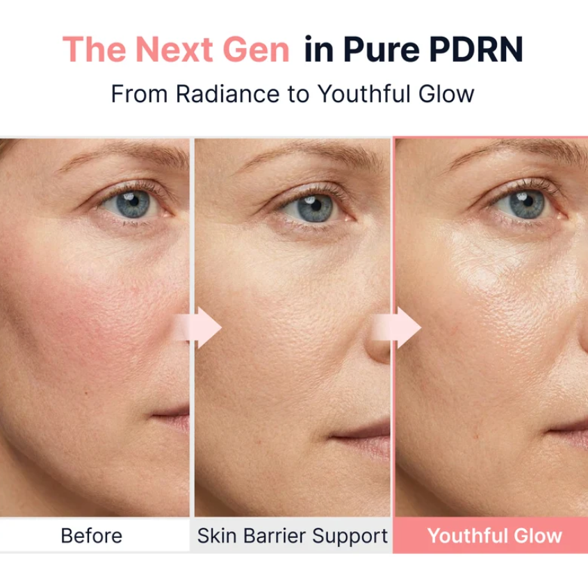 PDRN Pink Vitamin - Glow Boosting Ampoule sbedt by Sungboon Editor