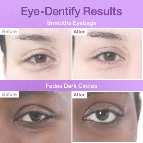 No.9 NAD Under Eye Patches by Numbuzin