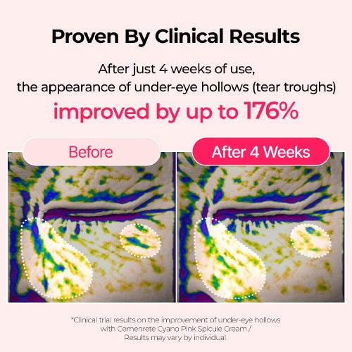 Cemenrete Cyano Pink Spicule Serum by Dr.Melaxin